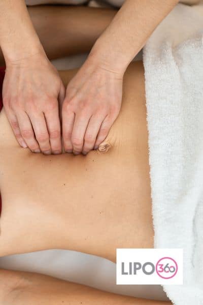 diastasis recti treatment Woodley 