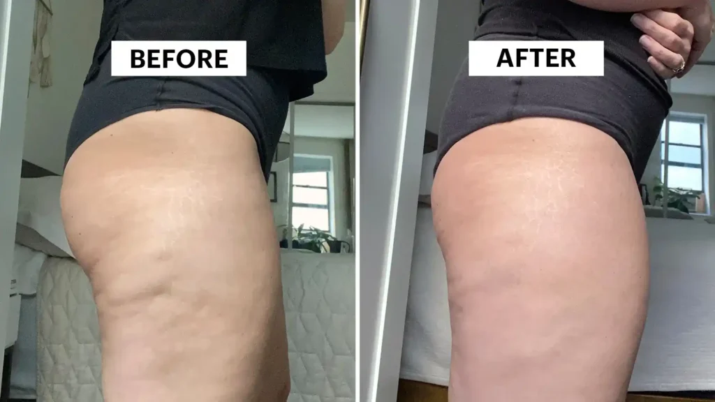 Do Toning Exercise Woodley  Really Tackle Cellulite?