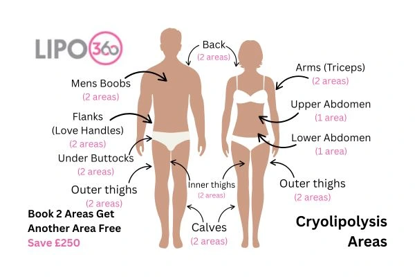 Cryolipolysis fat freezing prices from Lipo 360 Woodley 